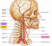 Image result for Where Are the Carotid Arteries