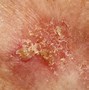 Image result for Dotted Skin