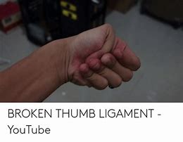Image result for Thumb Ligament Meme