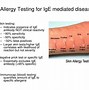 Image result for Apple Juice Allergy