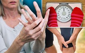 Image result for Weight loss arthritis