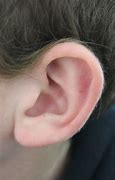 Image result for World's Smallest Ears