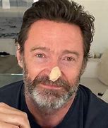 Image result for Hugh Jackman Skin Cancer On Nose