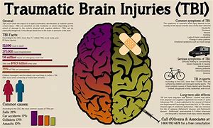 Image result for Brain Damage Drawing
