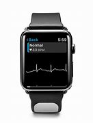 Image result for Apple Watch Arrhythmia Detector