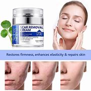 Image result for Scar Removal Cream