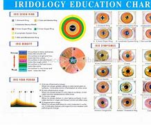 Image result for Iridology Yellow Ring around Pupil