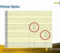 Image result for Wicket Spikes EEG