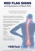 Image result for Red Flags for Back Pain