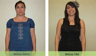 Image result for 35 Pound Weight Loss