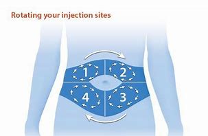 Image result for Diabetic Injection Sites