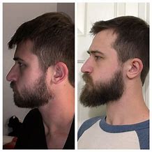 Image result for Weak Beard