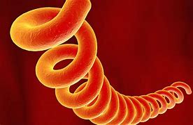 Image result for Syphilis