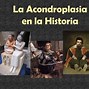 Image result for acondropladia