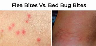 Image result for What Do Flea Bites Bed Bug Look Like