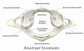 Image result for Atlas Vertebrae Anatomy