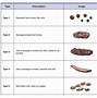 Image result for Very Dark Brown Stool Color