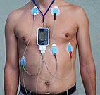Image result for Philips Patch Fetal Monitoring