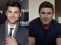 Image result for Zac Efron Broken Jaw