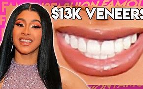 Image result for Cardi B Veneers