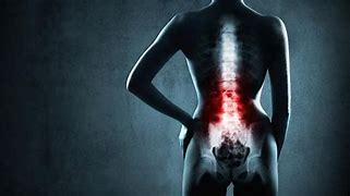 Image result for Back Stretching X-ray
