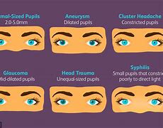 Image result for How Big Is 2 Cm Dilated