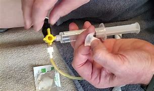 Image result for Biliary Drain Kit