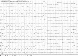 Image result for Oirda EEG