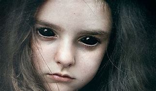 Image result for Child with Black Eye