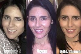 Image result for Vegan Keto Diet Change Face