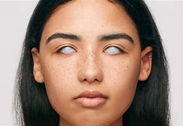 Image result for All White Contact Lenses