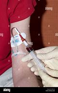 Image result for Blood Draw From PICC Line