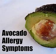 Image result for Avocado Allergy Symptoms