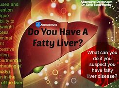 Image result for Fatty Liver Meme