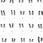 Image result for Chromosome Ideogram