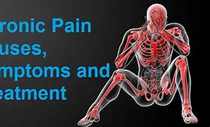 Image result for Chronic Muscle Pain