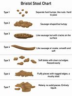 Image result for Poop Stool Chart