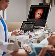 Image result for Philips 5000 Ultrasound