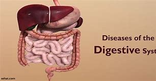 Image result for Digestive Illnesses