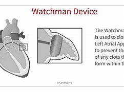 Image result for Watchman and Electrocautery