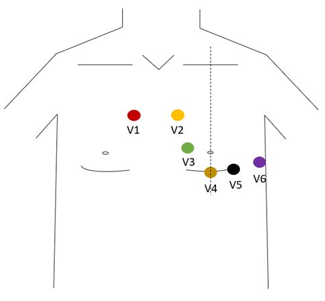 Image result for Sampling Methods Made Simple