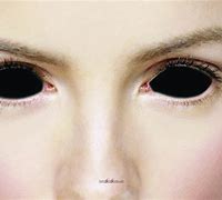 Image result for All-Black Eyes