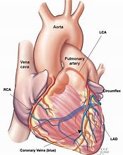 Image result for 4 Major Arteries