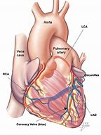 Image result for RCA Artery