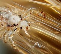 Image result for Human Crabs STDs