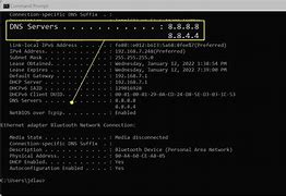 Image result for DNS Server Command Prompt