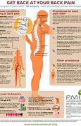 Image result for Lower Back Pain Location Chart