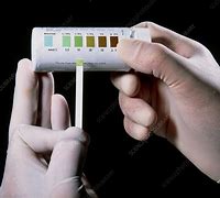 Image result for Urine Test for Diabetes