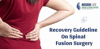 Image result for Back Fusion Surgery Recovery