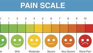 Image result for 1 10 Visual Pain Scale